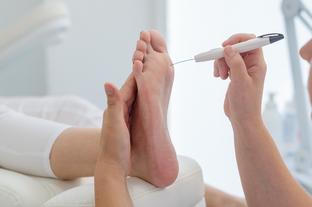 Ein Podologe untersucht den diabetischen Fuß mit einer Diabetik-Fußsonde.